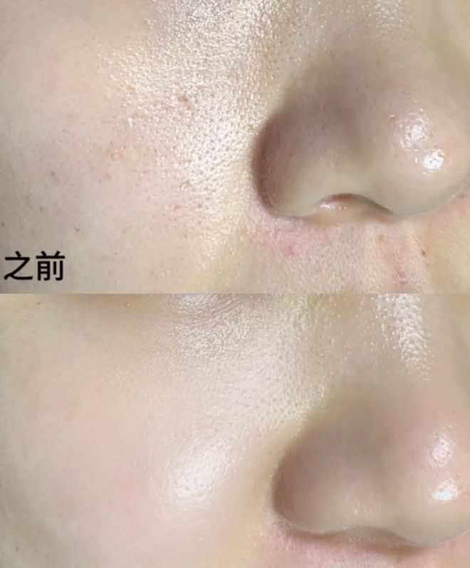 的十大面膜十大平价好用补水面膜推荐！AG真人百家家乐平台国内公认最好用(图3)